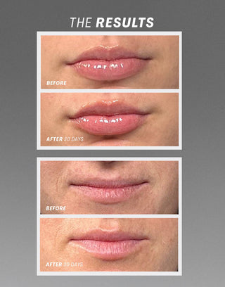 Lip Oasisᵀᴹ Glossy Treatment - Sugar Co.