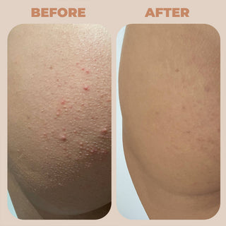 Miami Beach Bum | Bum and Body Cream Orange Mini 6oz - Sugar Co.